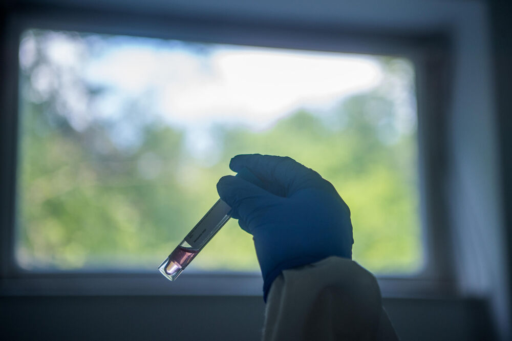 Test na koronavirus, Koronavirus, Uzorak, Naučnik, Laboratorija
