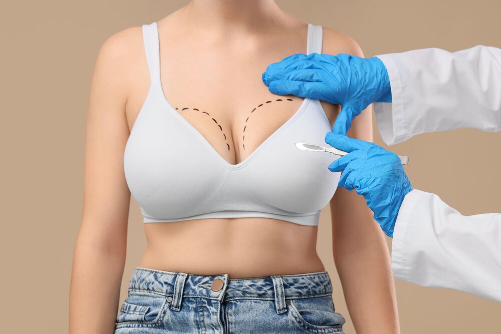 Plastična operacija, Estetska hirurgija, povećanje grudi, Silikoni